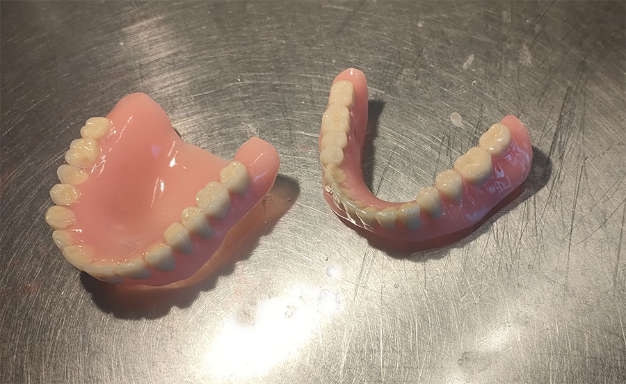 Réalisation de prothèses amovibles