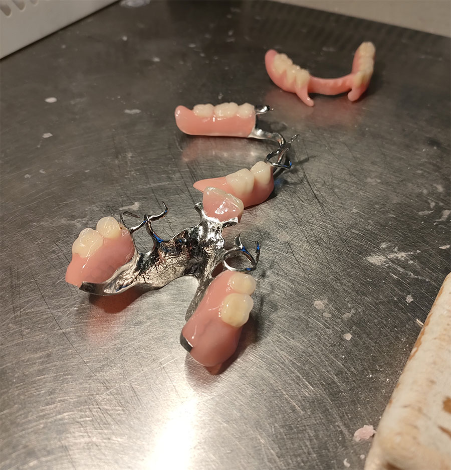 Détails de prothèse amovible complète