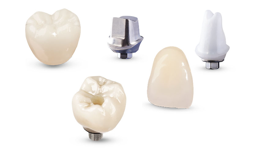 Détails de couronnes et piliers implantaires